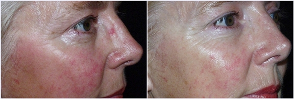 Software: Microsoft Office